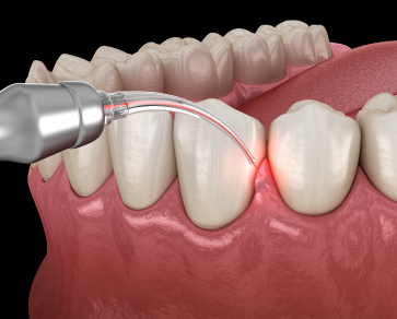 dental services
