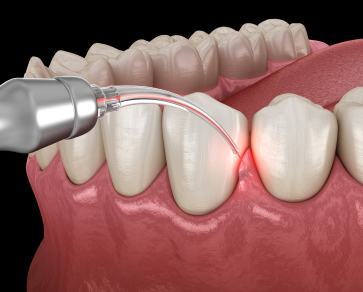 dental services